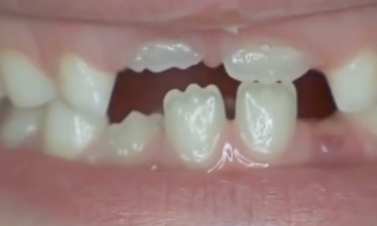 <a href=https://www.zgjmorg.vip/tag/mengjian/ target=_blank class=infotextkey>梦见</a>牙掉了是什么意思 <a href=https://www.zgjmorg.vip/tag/mengjian/ target=_blank class=infotextkey>梦见</a>牙掉了是什么意思