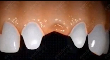 梦到<a href=https://www.zgjmorg.vip/tag/yachi/ target=_blank class=infotextkey>牙齿</a>掉了是什么意思 梦到<a href=https://www.zgjmorg.vip/tag/yachi/ target=_blank class=infotextkey>牙齿</a>掉了是什么意思