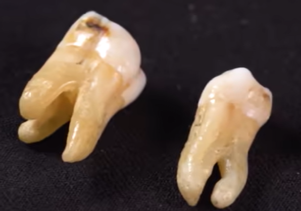 <a href=https://www.zgjmorg.vip/tag/zuomeng/ target=_blank class=infotextkey>做梦</a>梦到<a href=https://www.zgjmorg.vip/tag/yachi/ target=_blank class=infotextkey>牙齿</a>掉了是什么意思 <a href=https://www.zgjmorg.vip/tag/zuomeng/ target=_blank class=infotextkey>做梦</a>梦到<a href=https://www.zgjmorg.vip/tag/yachi/ target=_blank class=infotextkey>牙齿</a>掉了是什么意思