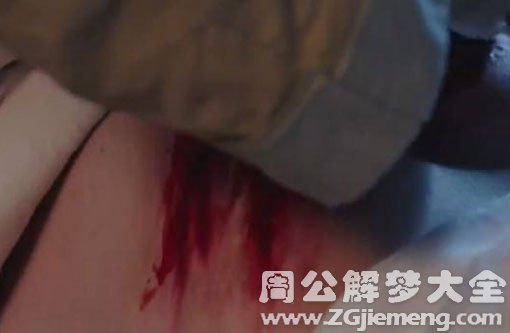 孕妇梦见屁股流血 孕妇梦见屁股流血