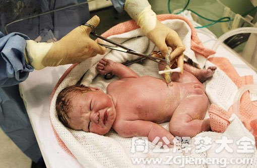 孕妇梦见脐带 孕妇梦见脐带